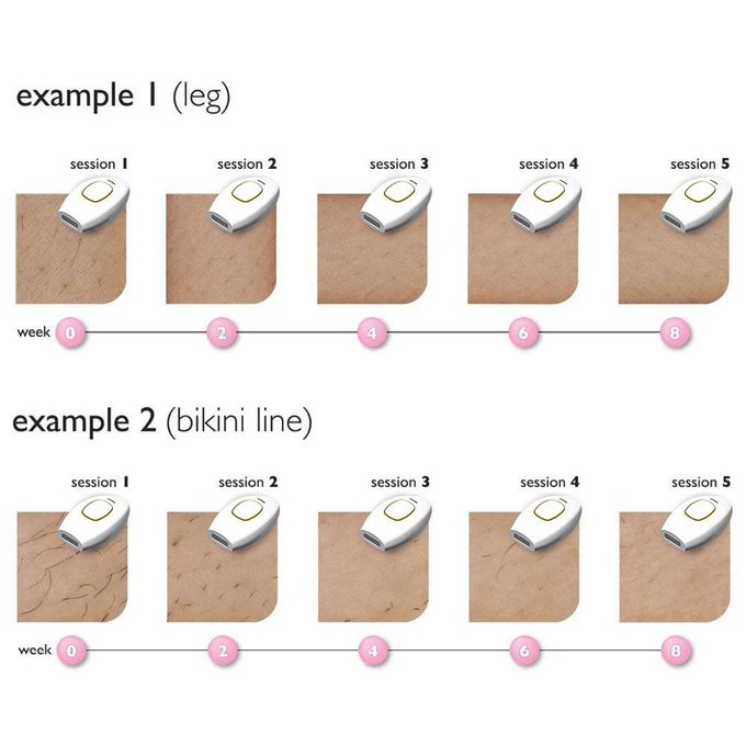 ودّعي الشعر غير المرغوب فيه... مرحباً بالبشرة الناعمة والمخملية!