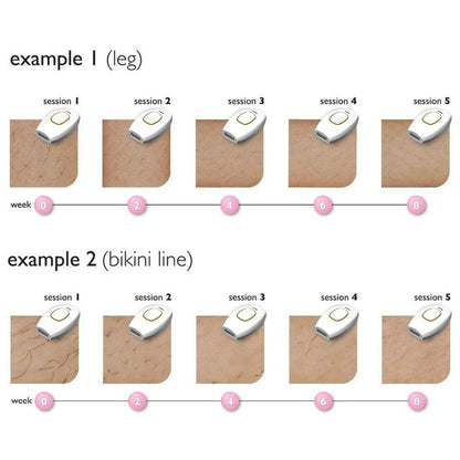 ودّعي الشعر غير المرغوب فيه... مرحباً بالبشرة الناعمة والمخملية!